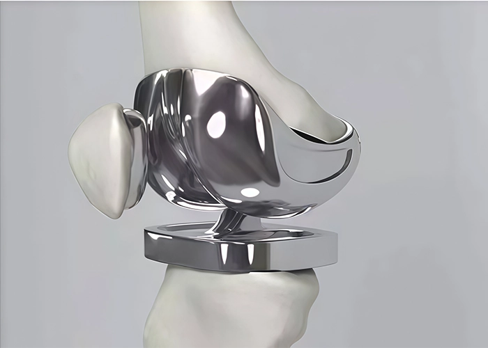 UHMWPE artificial joint component used for low-friction and wear-resistant medical applications